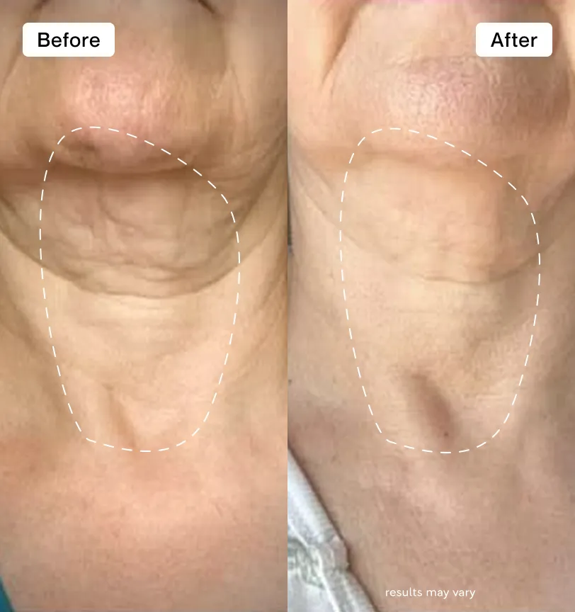 Changes in my neck area