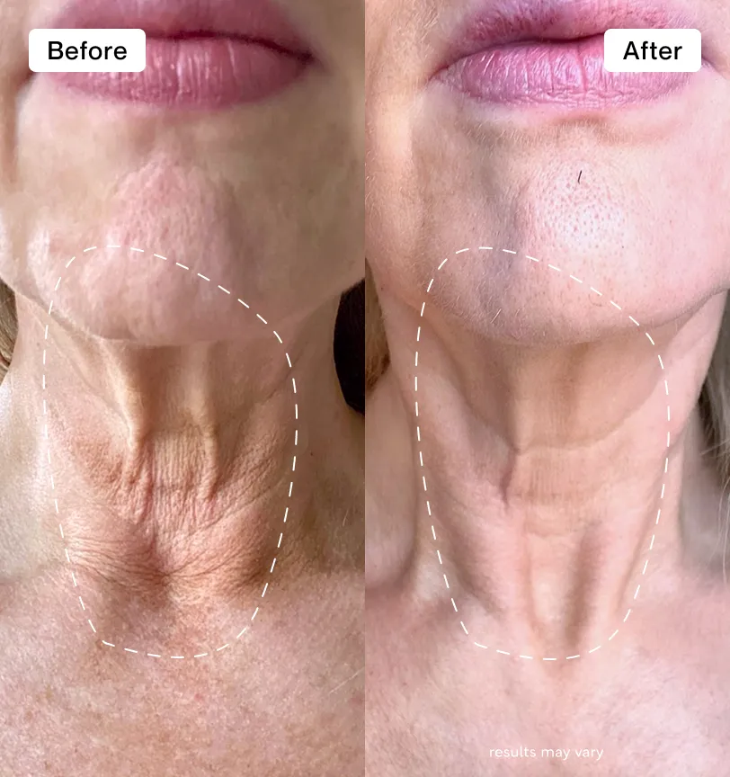 The best I've found for my neck