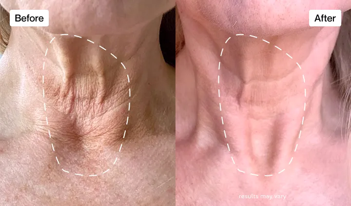 The best I've found for my neck