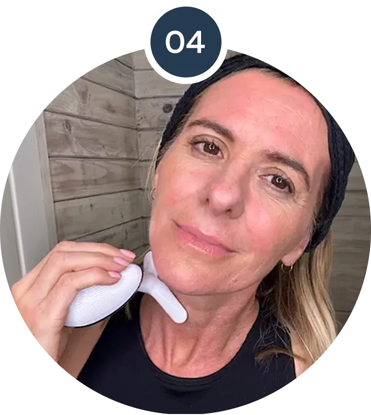 Use RenewaLift across the lower face