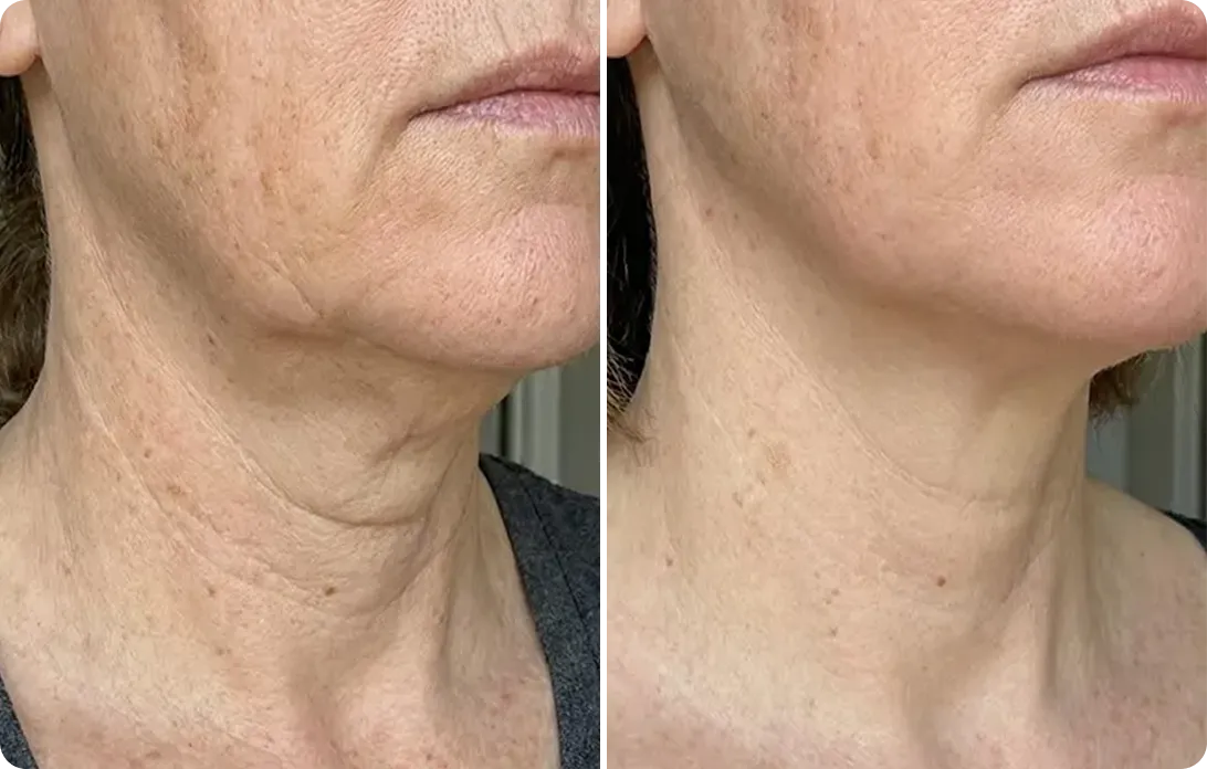 Margaret before and after
