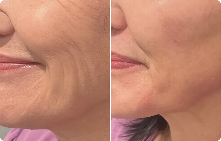 Carolyn before and after