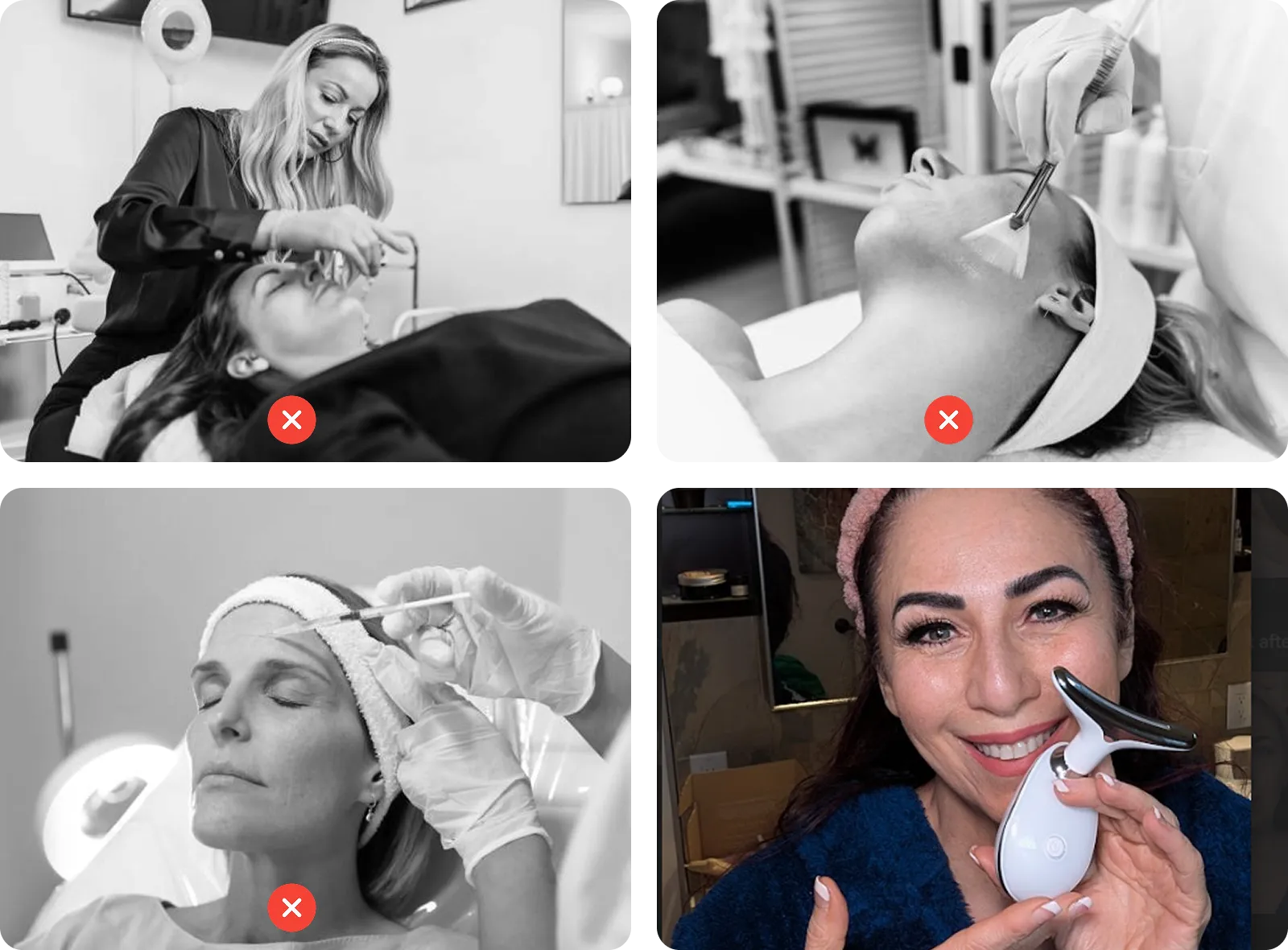 Professional treatments compared with RenewaLift