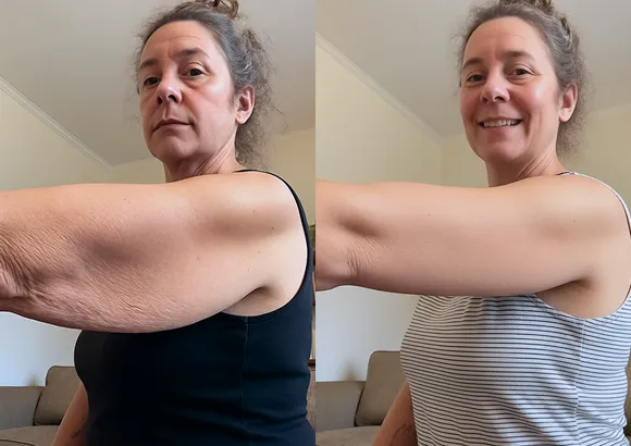 Tissue system comparison