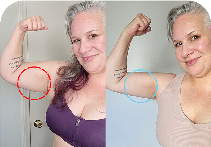 Atena MyoGlow review crepey arm skin