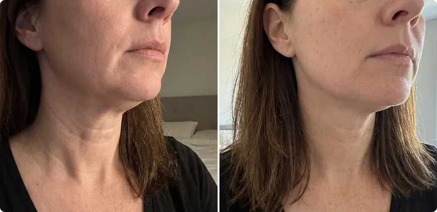Customer result 1