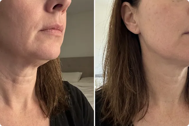 Customer result 1