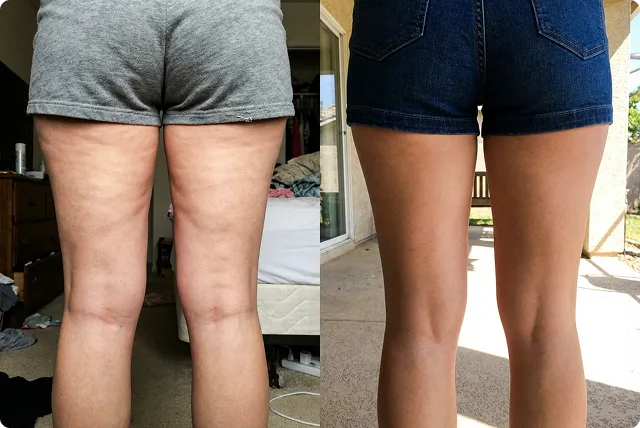 Customer result 6