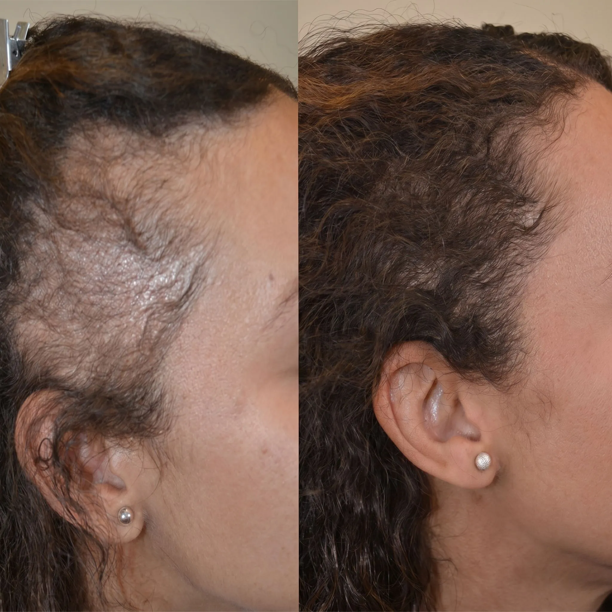 Before and After 3