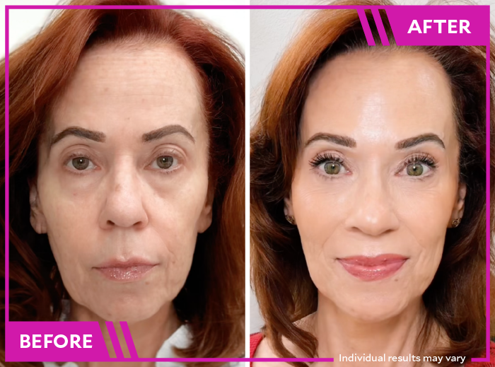 MoistureWiser Face 1