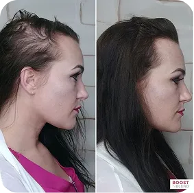 Before / After