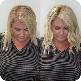 Before / After