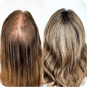 Before / After