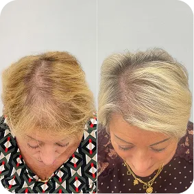 Before / After