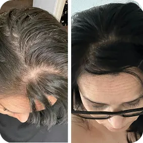 Before / After