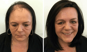 Before / After