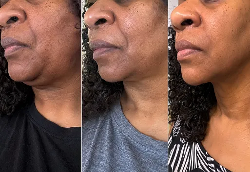 Customer before and after
