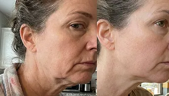 Customer before and after