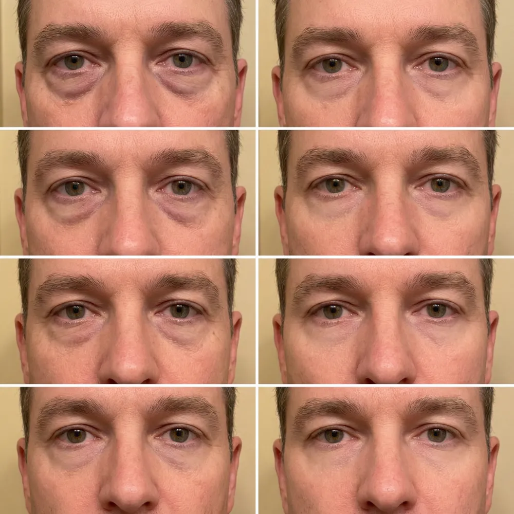 Before and after results