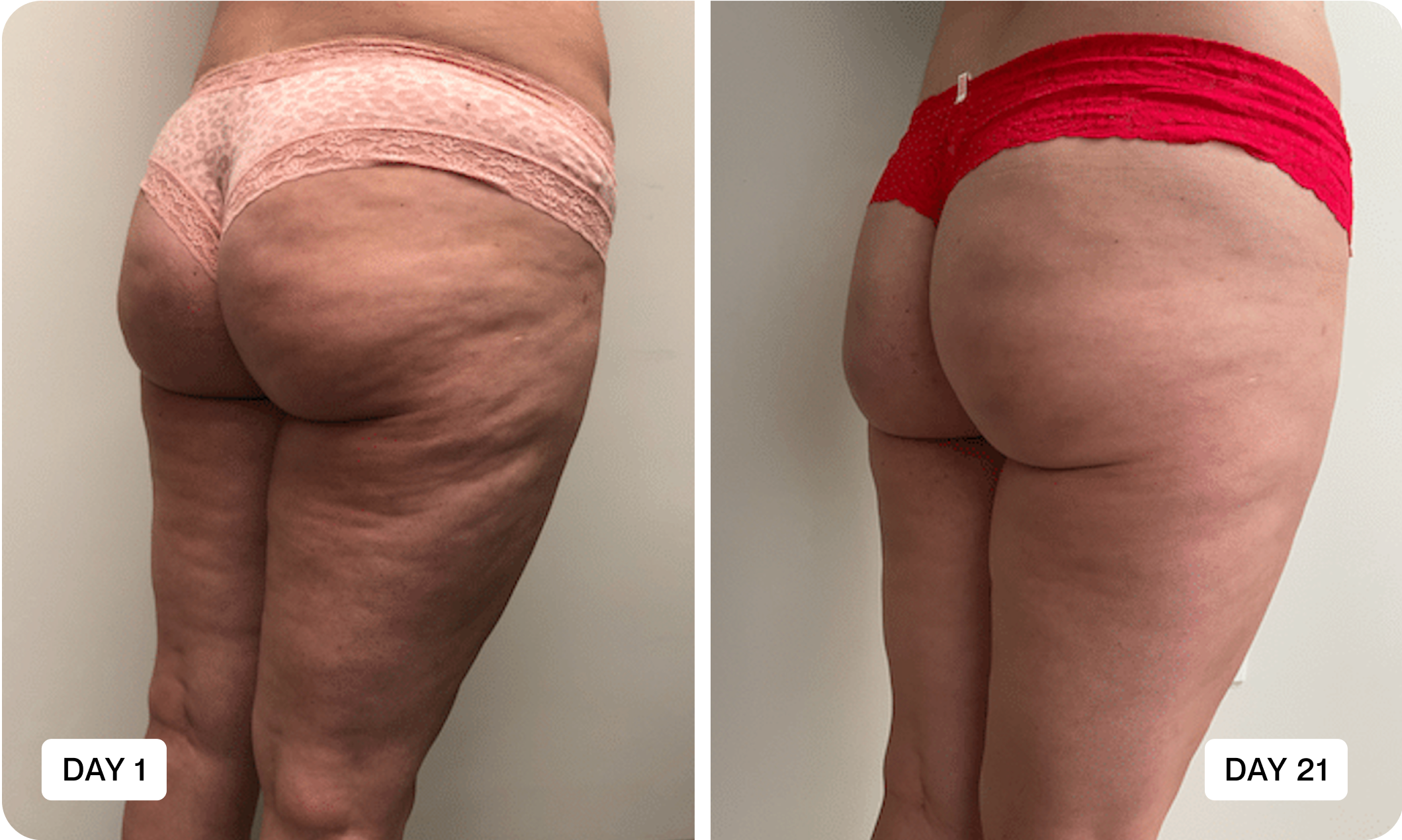 before-after
