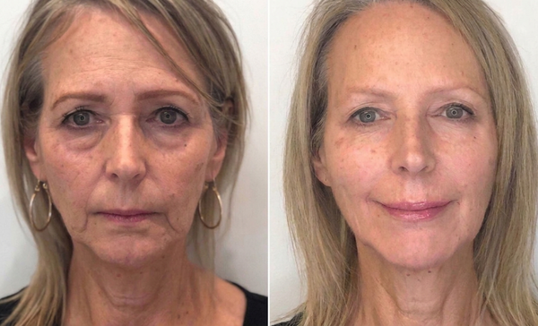 Soft smooth-looking skin