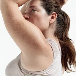 Woman with clear skin — birth control doesn't treat endometriosis article