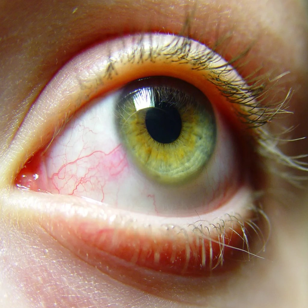 Sightcare-mbl