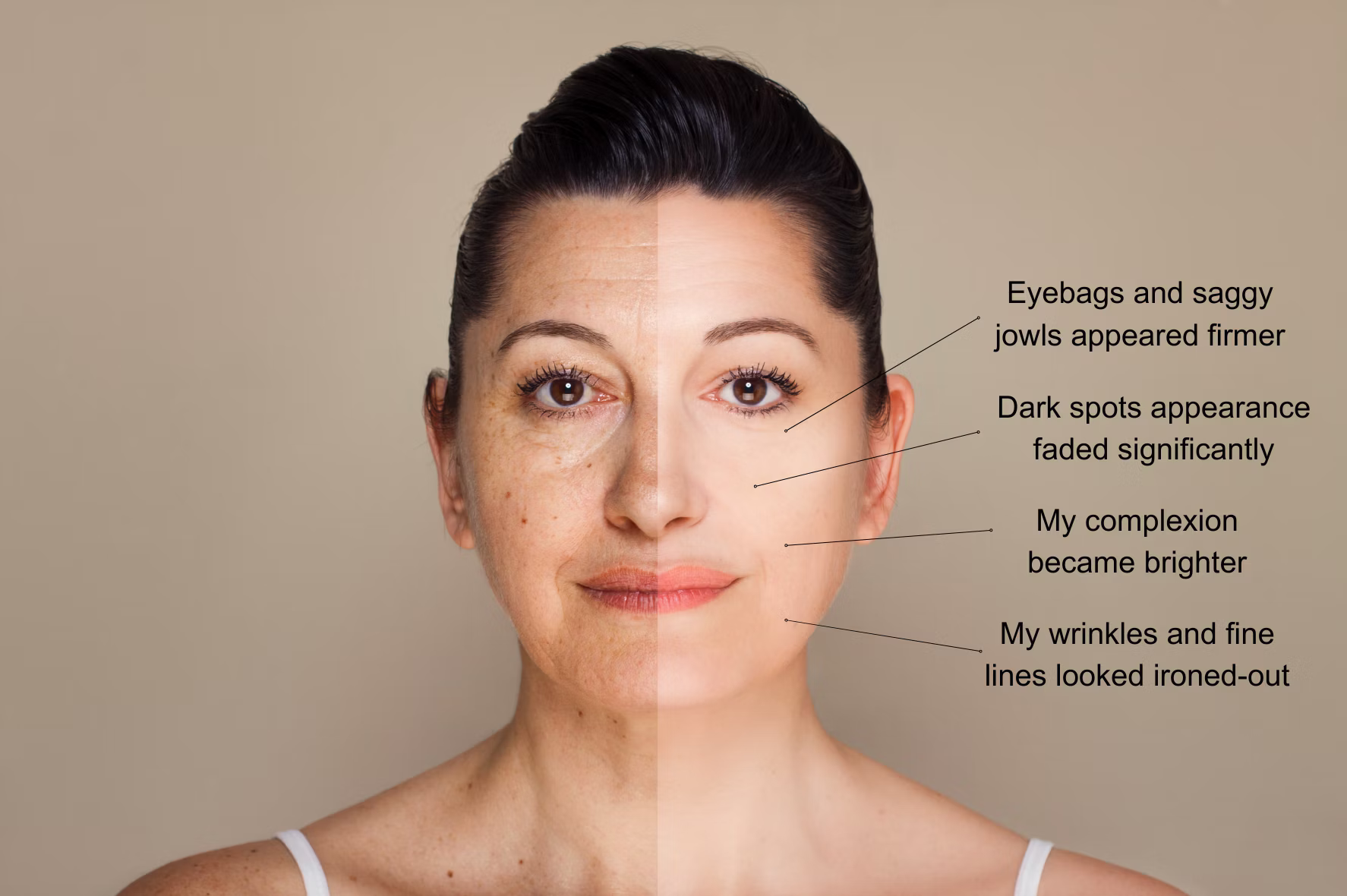 Nancy's face before and after with arrows pointing to the improvements