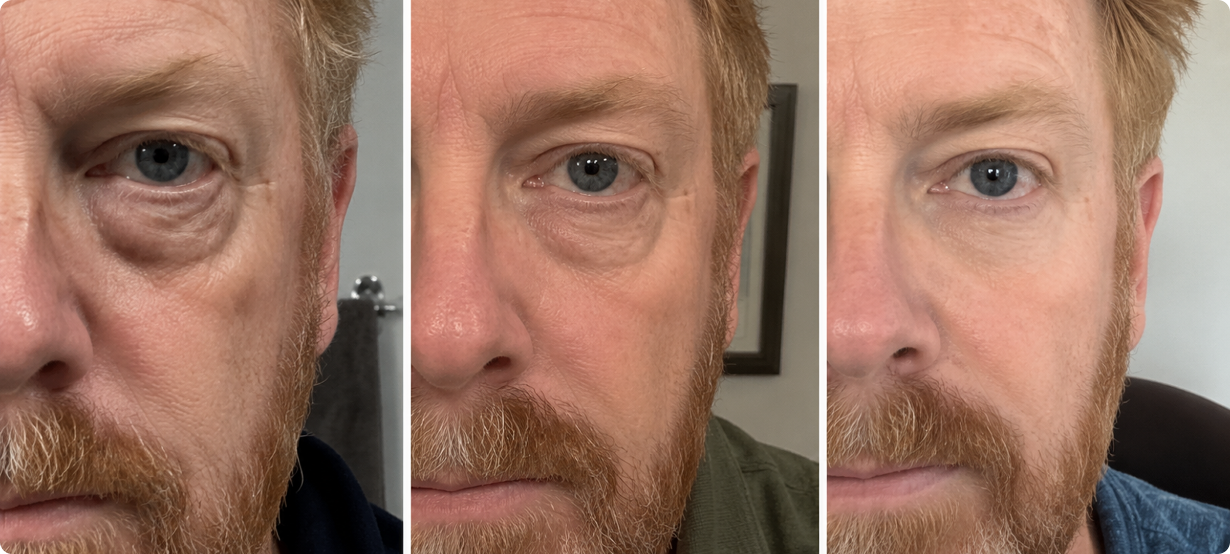 Hero: three before/after faces