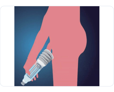 Illustration: positioning the pump against the pelvic floor
