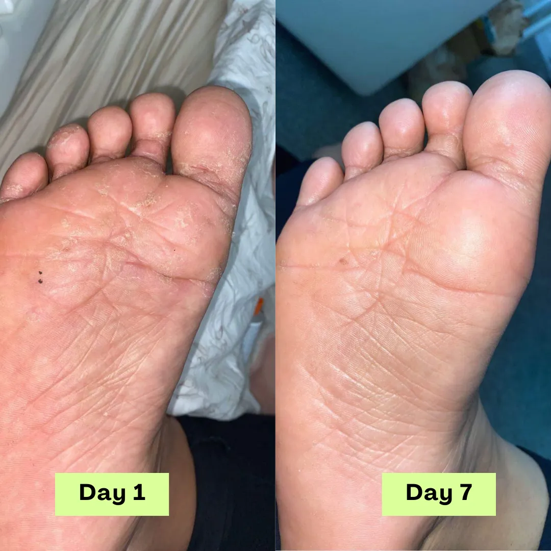 Day 1 feet