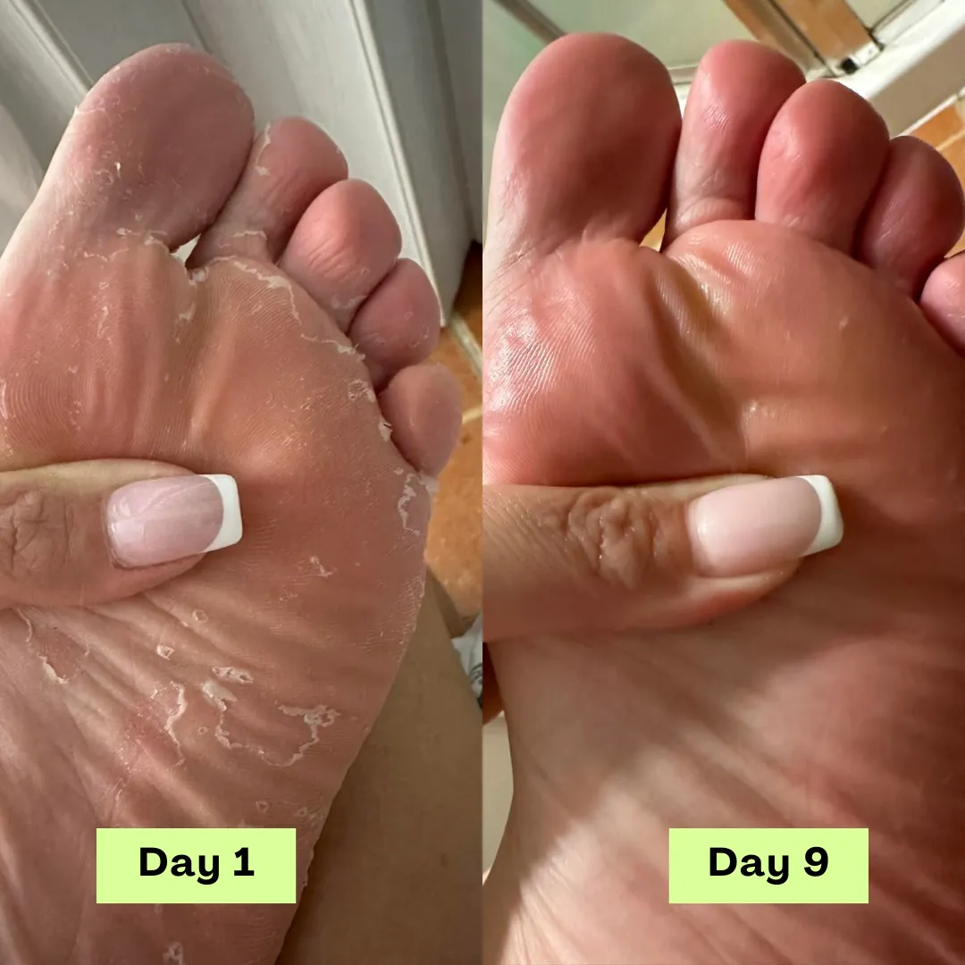 Day 1 sole