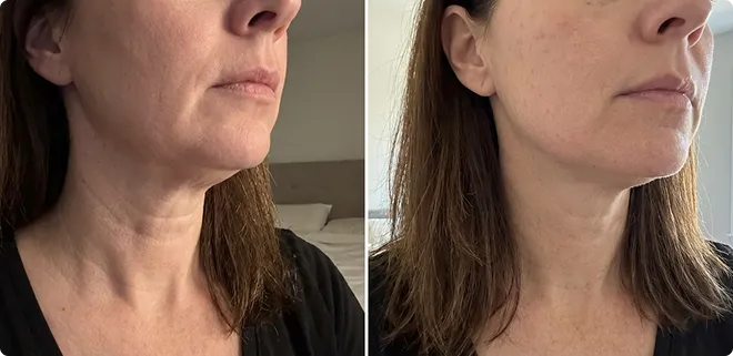 Customer before and after result