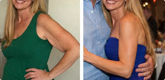 Customer before and after result