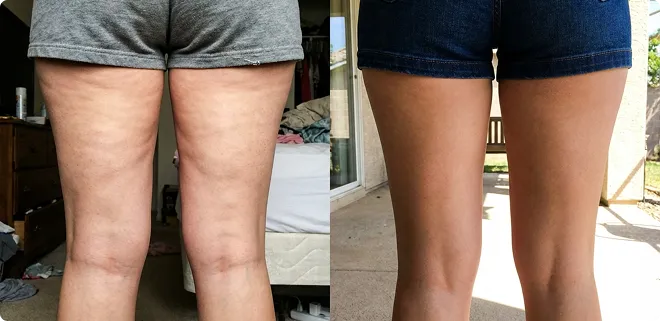 Customer before and after result
