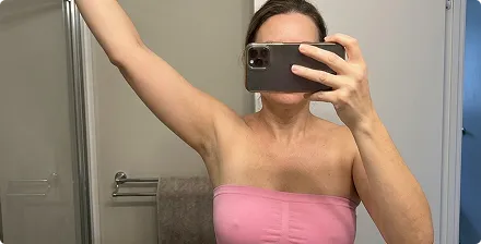 MyoGlow day 30 result