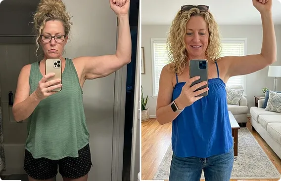 Before and after firmer arms result