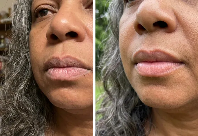 Customer before and after