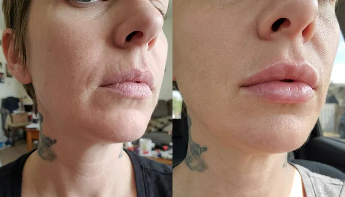 Customer before and after