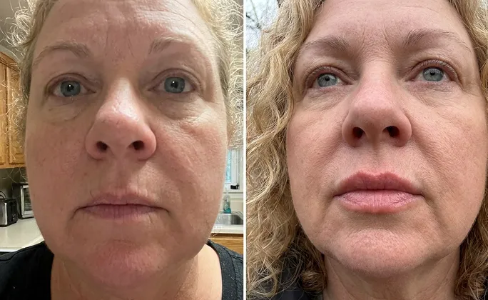 Customer before and after