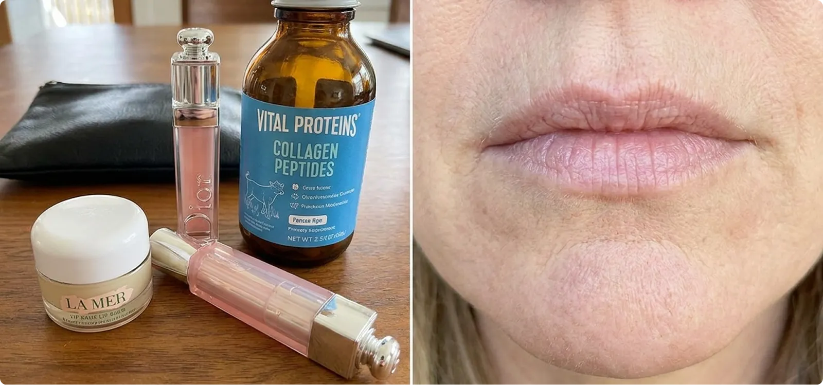 Collagen products beside a lip comparison