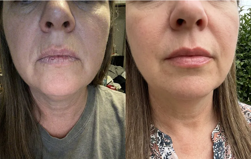 Deborah LipFill results