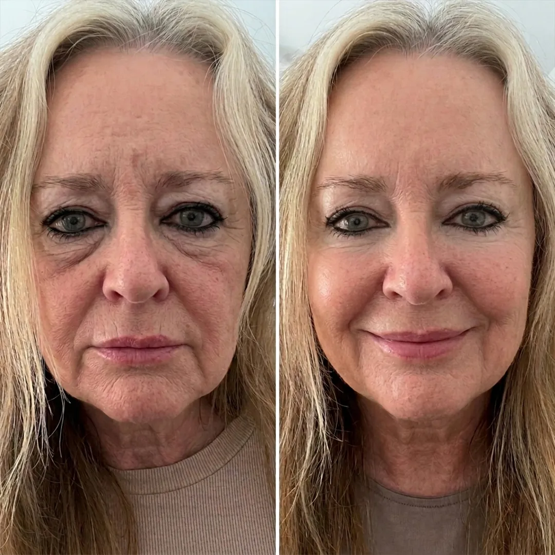 Customer result