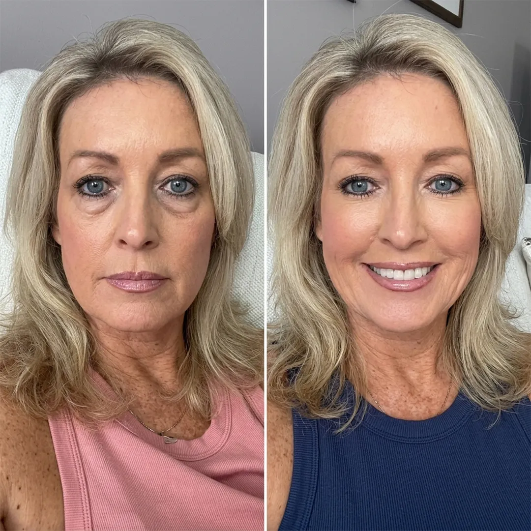 Customer result