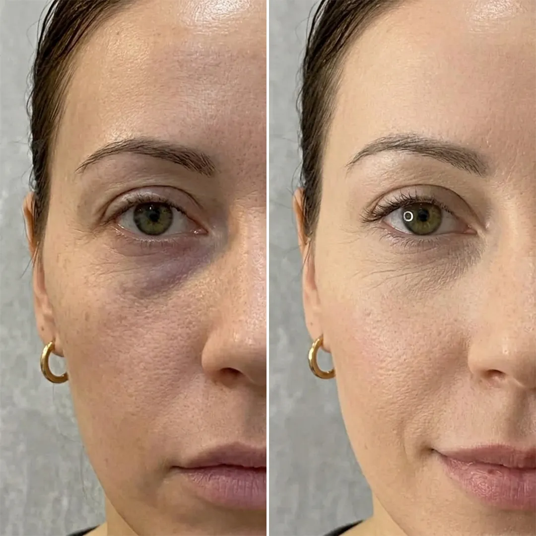 Customer result