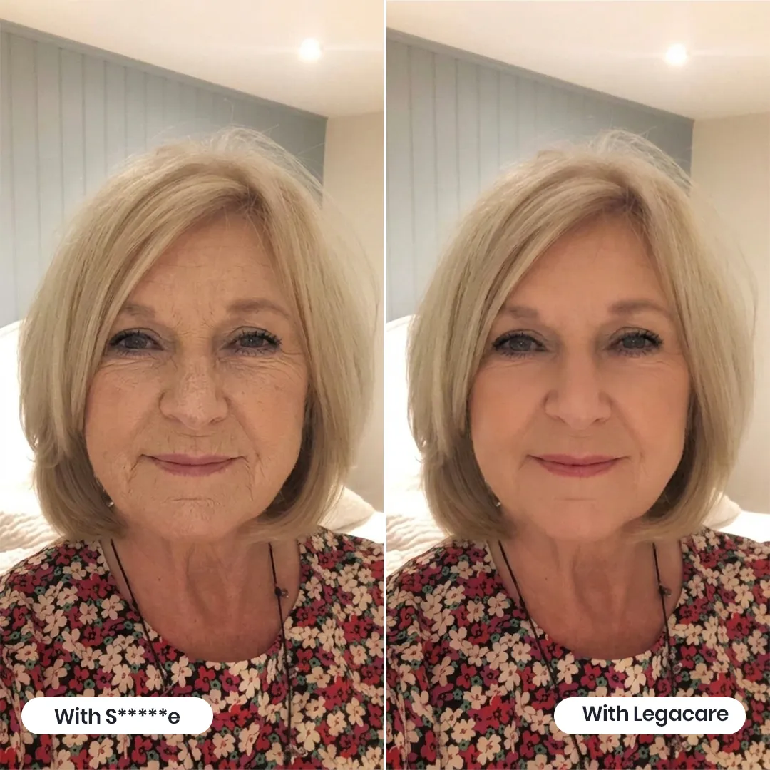 Side-by-side Smooche and Legacare comparison