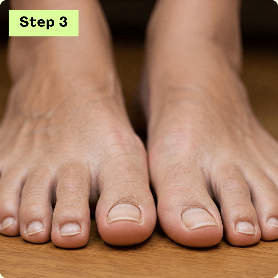 Step 3 - Heal